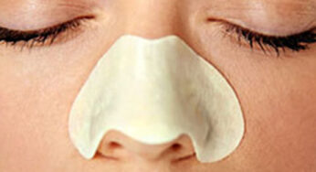 How To: Get Rid of Blackheads