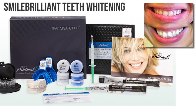 Teeth Whitening Before + After Transformation + $140 #GIVEAWAY!