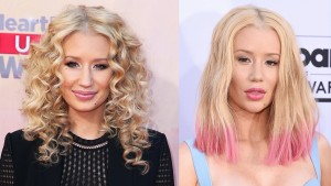 Iggy Azalea’s Nose Job, Before and After – Sassy Dove