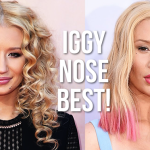iggy azalea nose job before after feature