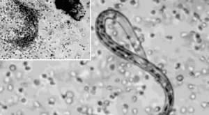 parasites-up-close-worm-in-cells-cellular-level