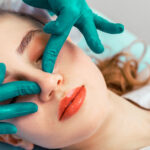 cosmetic surgeon nose lift brows lips medspa